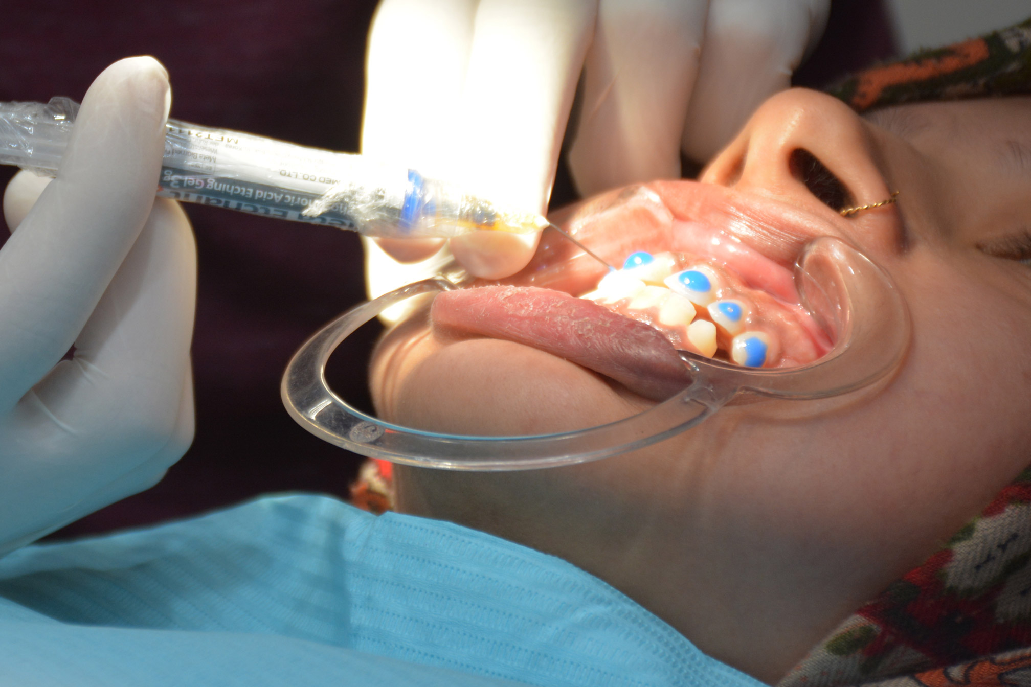 banner-intro-dental